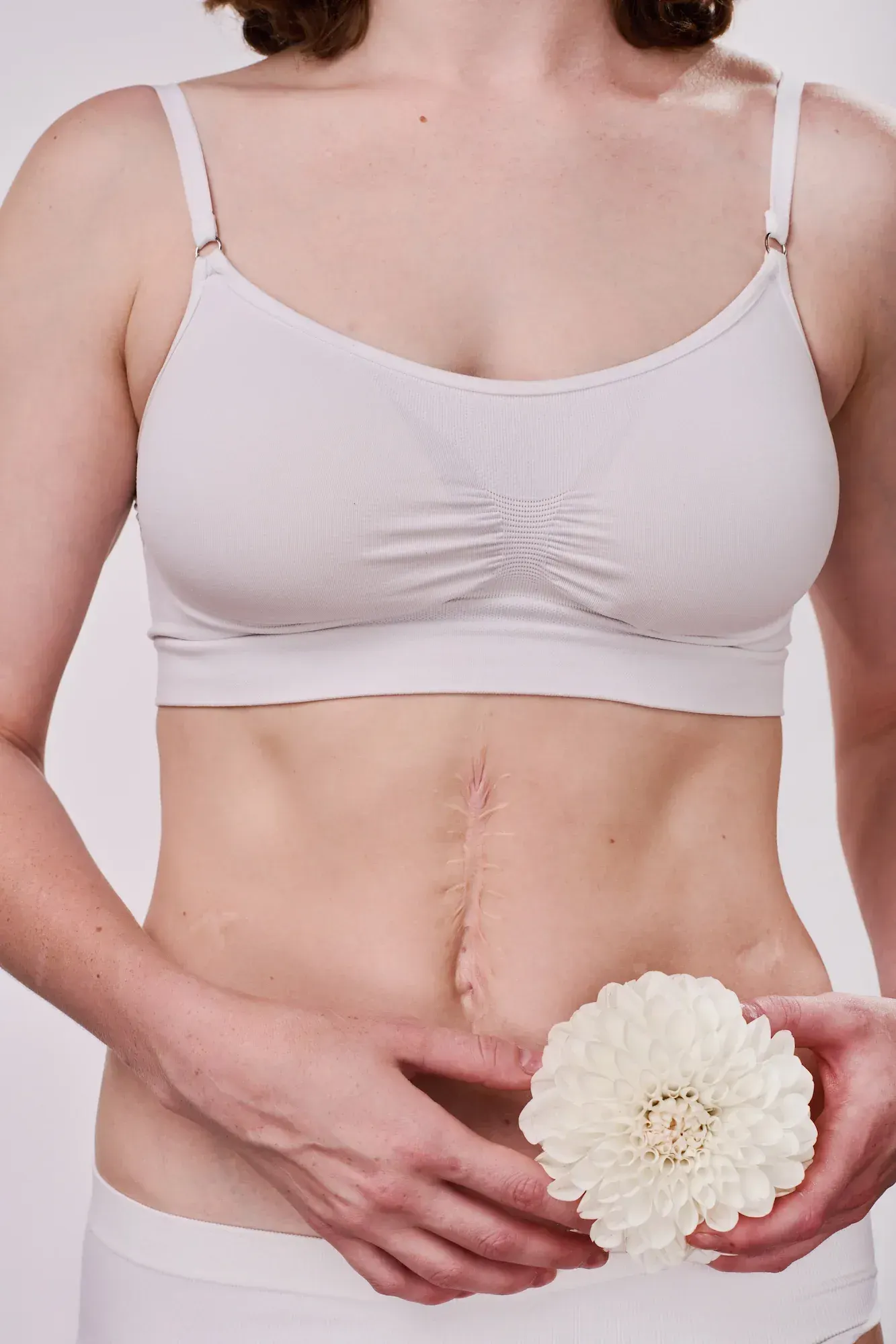 Understanding Diastasis Recti in Tampa, FL: Non-Surgical Core Repair with Emsculpt Neo